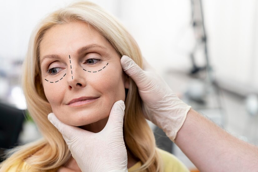 non surgical facelift london