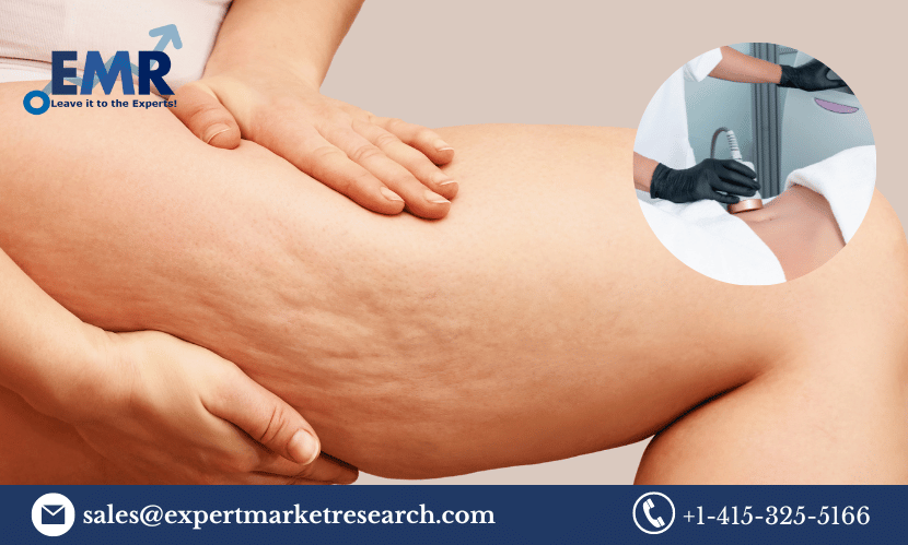 Global Cellulite Treatment Market Share, Trends, Growth, Outlook, Report and Forecast 2023-2028