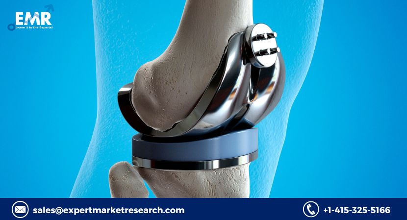 Global Medical Implant Market Size, Share, Price, Trends, Growth, Analysis, Report, Forecast 2023-2028