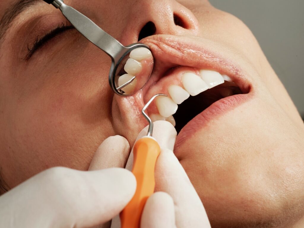 Understanding the Essentials of Root Canal Treatment