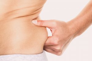 Say Goodbye to Stubborn Fat with Liposuction Surgery in Los Angeles