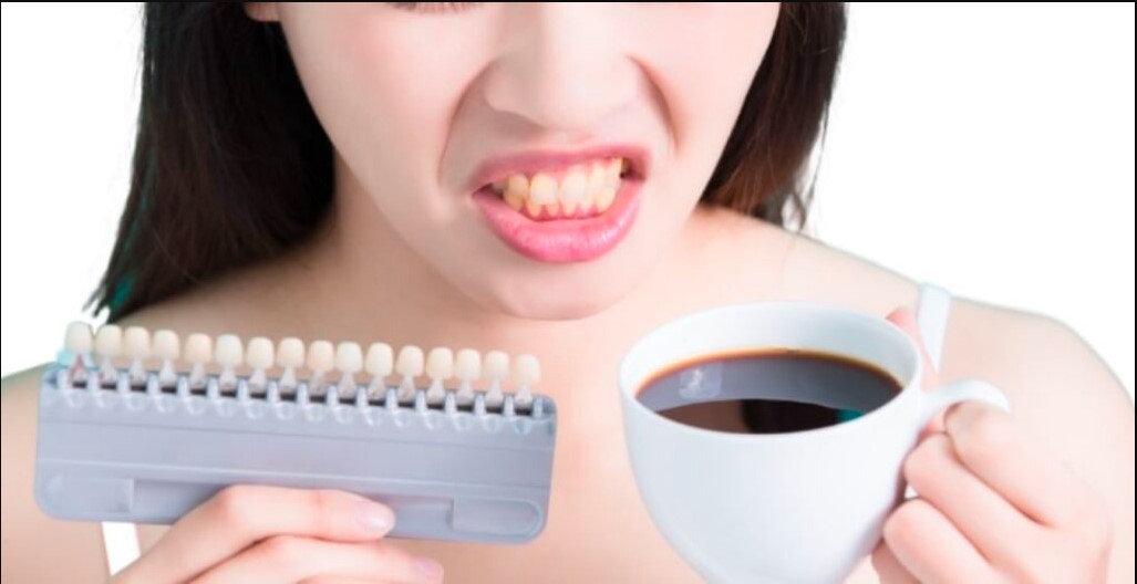 Coffee for Teeth Whitening