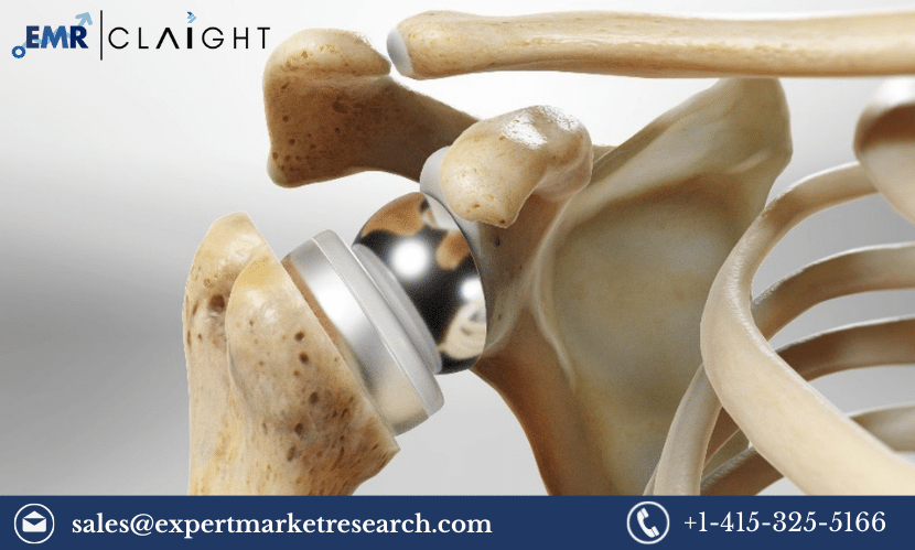Global Shoulder Replacement Market Size, Price, Growth, Trends, Analysis, Research Report and Forecast 2024-2032