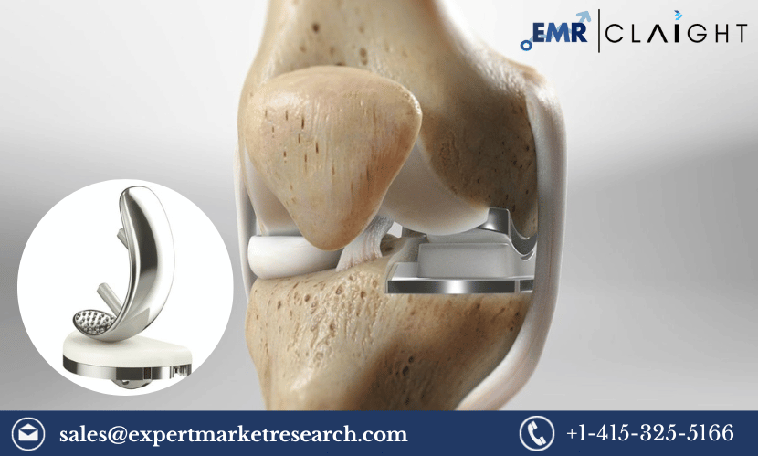 Global Unicompartmental Knee Prostheses Market Size, Trends, Growth, Outlook, Report and Forecast 2024-2032