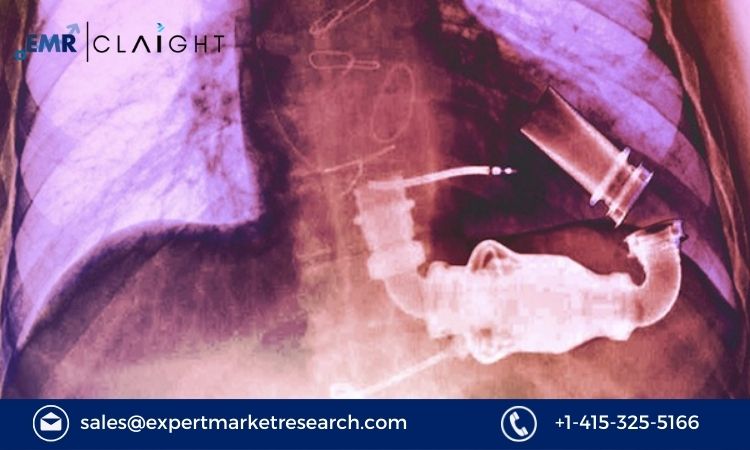 Ventricular Assist Device Market Size, Share, Growth 2024-2032