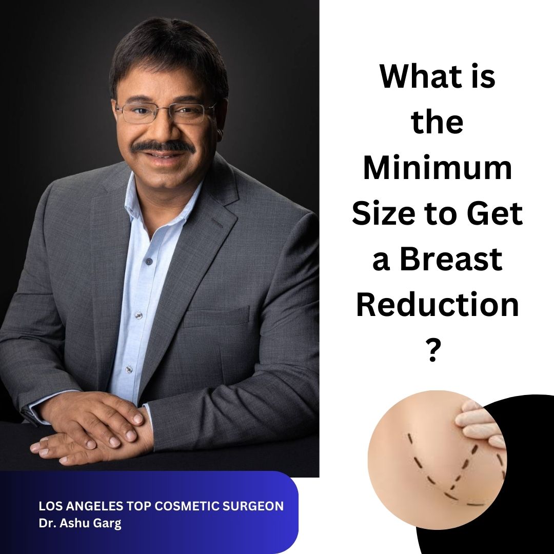 What is the Minimum Size to Get a Breast Reduction?