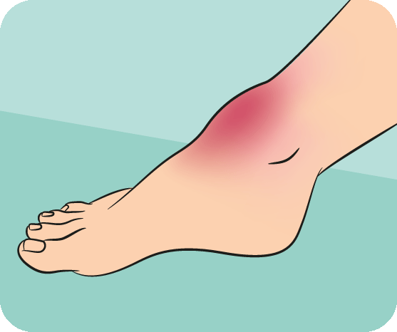 Can Foot Pain Cause Heart Problems?