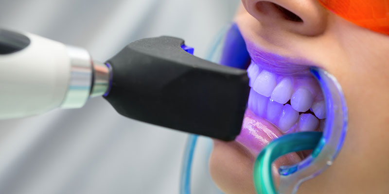 Unleashing Radiance: Examining Teeth Whitening Services And Costs
