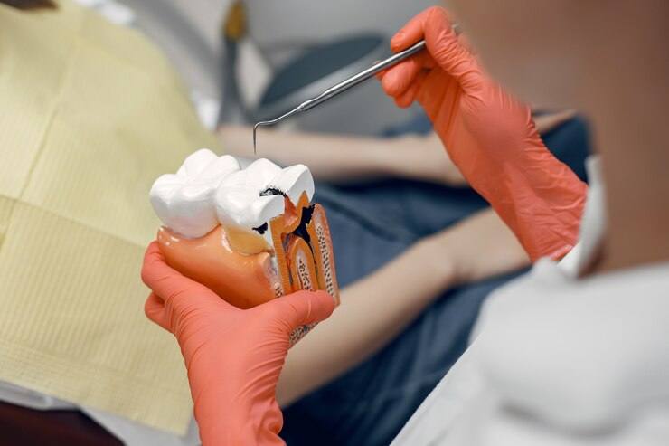 Discovering Dental Crowns in London: An Explorative Overview