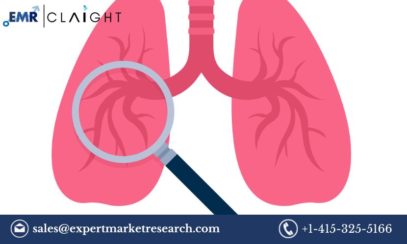 Lung Cancer Screening Market Growth: Exploring Trends, Key Players, and Innovative Technologies