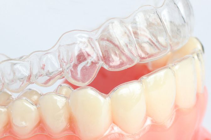 Benefits, Do’s and Don’ts of Eating With Invisalign