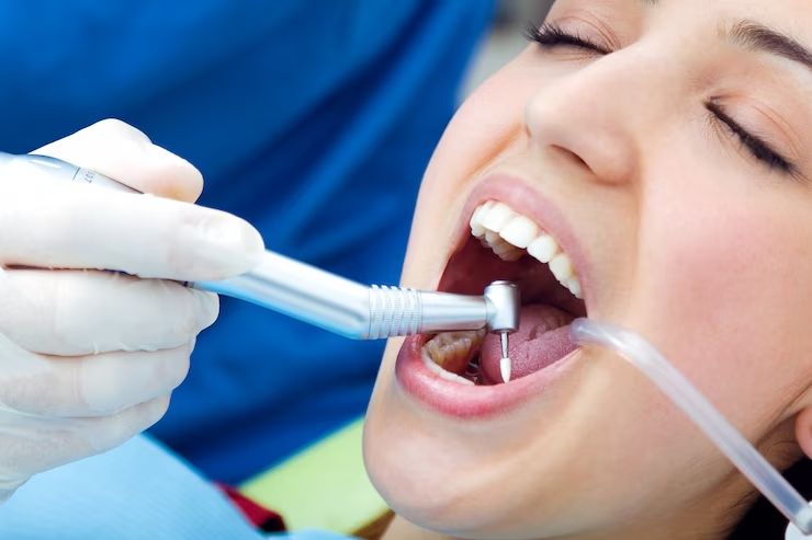 Dubai’s Dental Dilemma: Navigating Tooth Filling Expenses