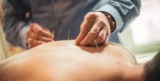 Learn All About Acupuncture In This Article
