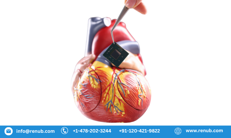 Cardiac Holter Monitor Market Size, Forecast 2023-2030