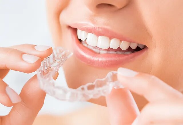 Invisalign London: Everything You Need To Know In 2024