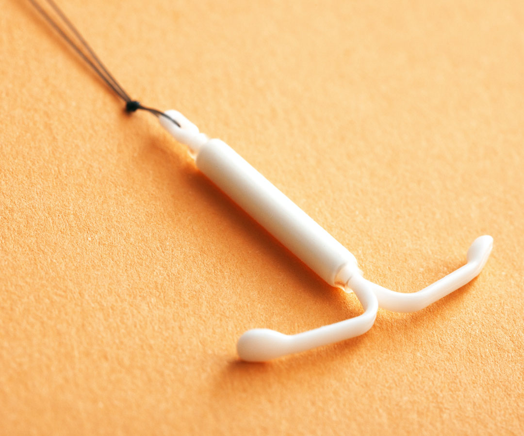 Understanding The Process Of IUD Insertion With Mirena In Dubai