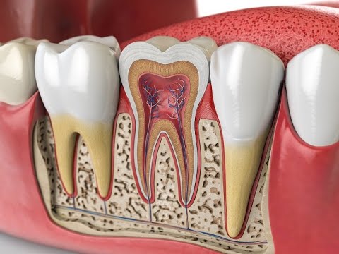 root canal cost in Toronto
