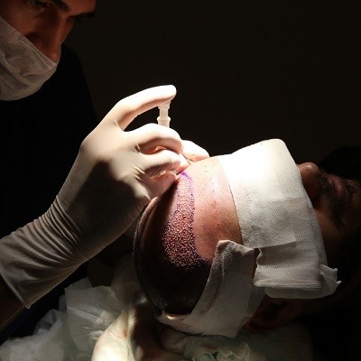 Unlock Hair Renewal: Islamabad’s Transplant Specialists