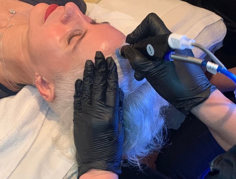 From Dull to Dazzling: Transform Your Scalp with HydraFacial