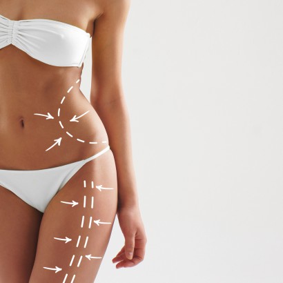 Dubai Liposonix: Your Gateway to a Slimmer, More Defined You