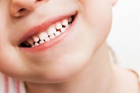 Comprehensive Care for Children’s Adult Teeth with Dental Implants in Hertfordshire