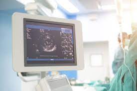 endocavity ultrasound services