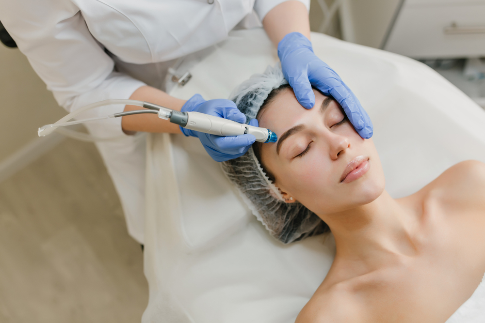 Microneedling Treatment Skin Health and Appearance