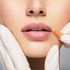 Lip Filler Injection in Dubai