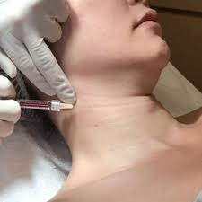 The Top Benefits of Botox Injections for Neck Care in Dubai