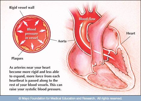 Comprehending the Causes of High Blood Pressure and the Dangers It Pose