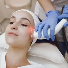 Why Pico Laser Treatment is the Best for Hyperpigmentation in Dubai