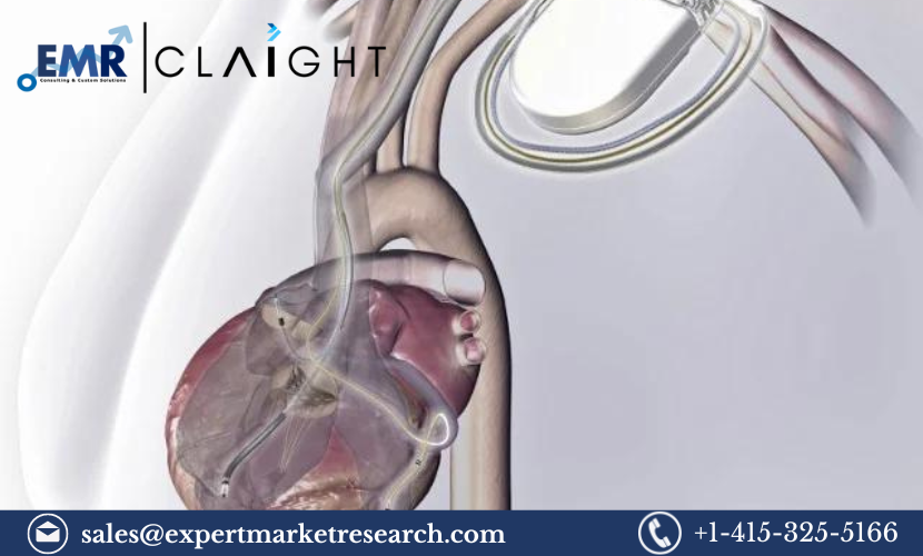 Smart Implantable Pumps Market: Trends, Growth, and Competitive Landscape 2032