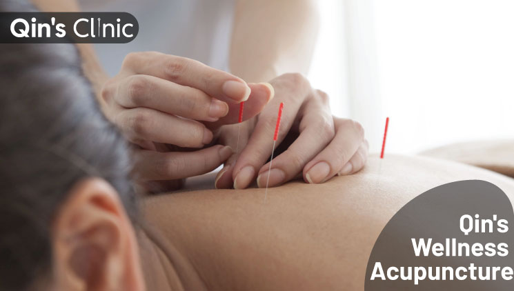 How Qin’s Acupuncture Improves Circulation to Aid Weight Loss