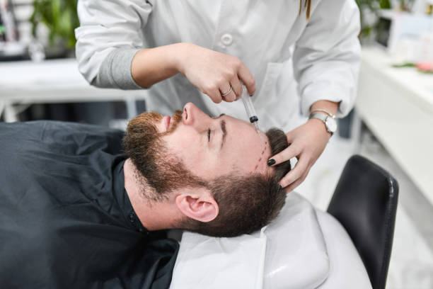 Hair Transplant Aftercare: Tips for Riyadh Patients