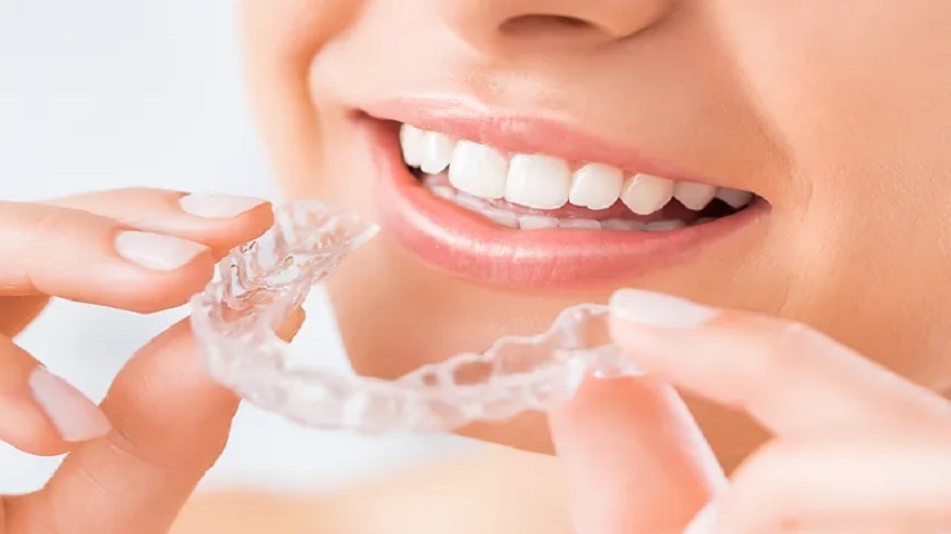 Invisalign Canada