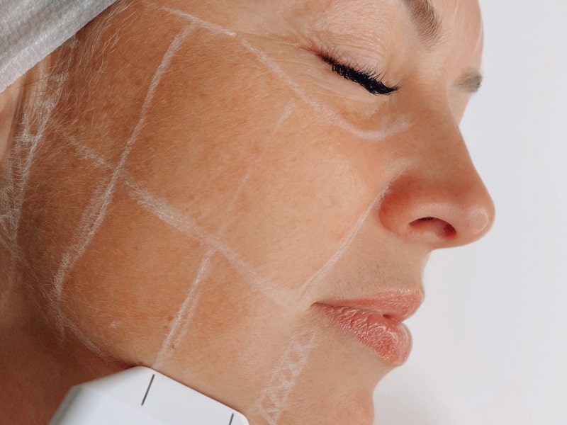 Discover the Secret to Youthful Skin: Skin Tightening at Skin Zest