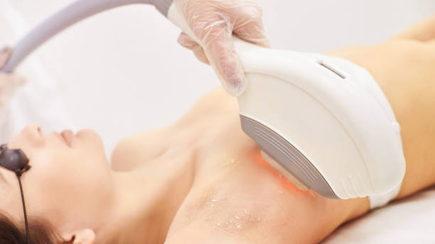 Experience Radiant Skin with Fractional CO2 Laser Treatment