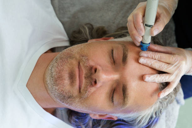 HydraFacial: The Key to Smooth and Hydrated Skin for Men