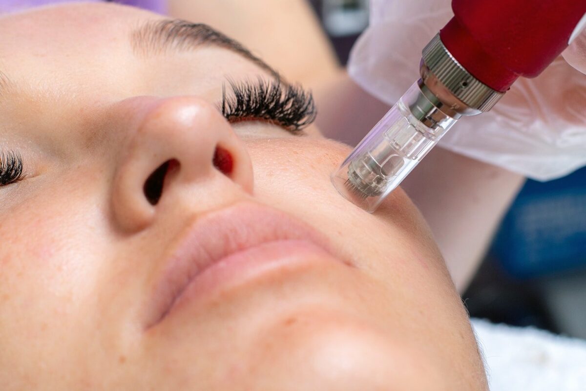 Unlock Radiant Skin with Hydra Needle Facial Treatment