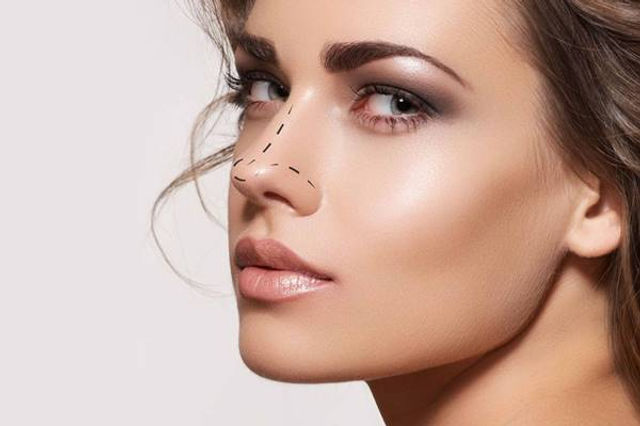 Rhinoplasty in Dubai