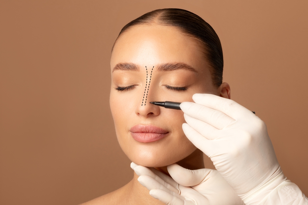 Is rhinoplasty only performed for cosmetic reasons?