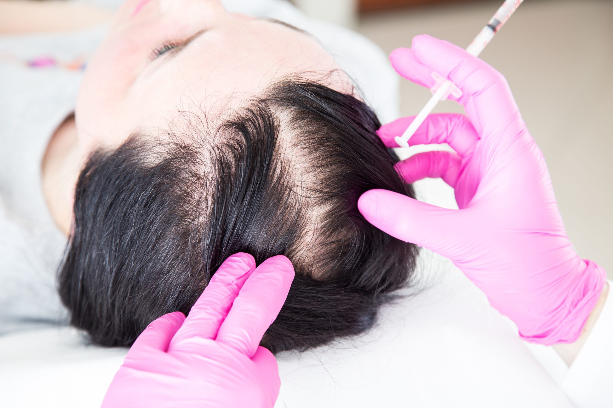 The Ultimate Guide to Scalp Therapy