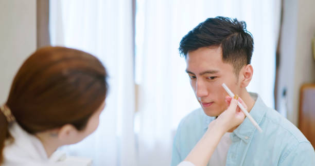 Why Choose Professional Acne Treatment?