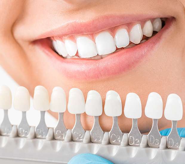 Smile Brighter with Advanced Cosmetic Dentistry in Medford OR