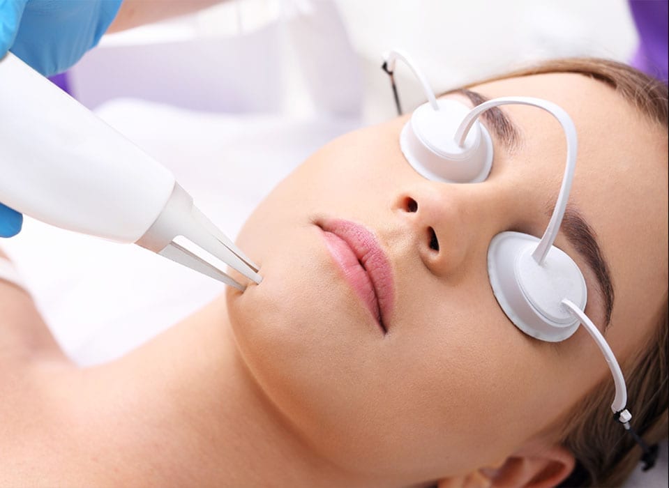 Acne Laser Treatment Cost in Dubai