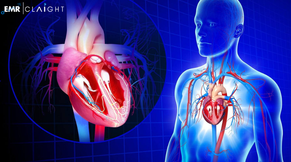 Global Cardiovascular Information System Market Share, Size, Trends, Growth, Outlook | 2024 – 2032