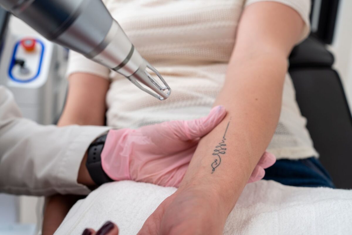 Laser Tattoo Removal Is It Safe for You?