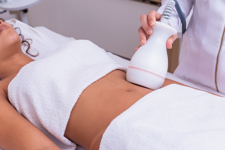 7 Benefits of Laser Liposuction You Should Know