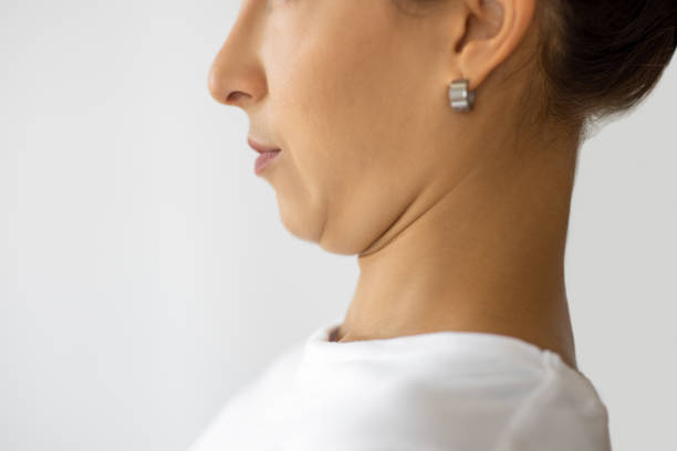 Non-Invasive Double Chin Removal for a Toned and Defined Jawline