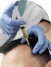 Hair Transplant in Riyadh